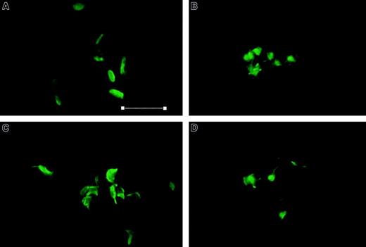 Fig. 10. Thrombin-induced morphologic changes are not affected by staurosporine and calpeptin. / Column-purified platelets were stimulated with thrombin 1 U/mL for 60 seconds, fixed with glutaraldehyde, and stained with AlexaFluor 488 phalloidin. (A) Control, (B) thrombin, (C) staurosporine (0.3 μM) for 30 minutes, then thrombin, and (D) calpeptin (200 μg/mL) for 30 minutes, then thrombin. All platelets stimulated with thrombin show extension of filopodia and lamellipodia with F-actin polymerization. Lack of aggregation in (D) is apparent. Bar = 7 μm. Magnification × 2400.