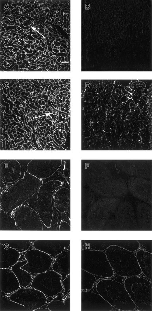 Fig. 4. Confocal microscopical analysis of renal cortex and testis stained with antiheparin antibodies and its sensitivity to heparinase III digestion. / Nontreated (A, C) and heparinase III–treated (B, D) cryosections of rat renal cortex, and nontreated (E, G) and heparinase III–treated (F, H) cryosections of rat testis were incubated with periplasmic fractions containing antiheparin antibody EW4B5 (A, B), antiheparin antibody EW4E1 (C-F) or antiheparin antibody EW4G2 (G, H). Bound antibodies were visualized by incubation with anti-VSV mouse monoclonal antibody P5D4, followed by Alexa 488–conjugated goat antimouse IgG. Note the difference in staining of the glomerulus in A and C and the difference in staining intensity after heparinase III digestion in B, D, F, and H. Scale bar, 100 μm.