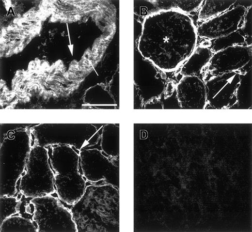 Fig. 5. Microscopical analysis of renal cortex and pancreas stained with antiheparin antibodies. / Cryosections of rat renal cortex (A-C) and pancreas (D) were incubated with periplasmic fractions containing antiheparin antibody EW4D5 (A, B) or antiheparin antibody EW4E9 (C, D). Bound antibodies were visualized by incubation with anti-VSV mouse monoclonal antibody P5D4, followed by Alexa 488–conjugated goat antimouse IgG. Small arrow in A indicates smooth muscle cells; large arrow in A, endothelium; arrow in B, peritubular capillary; asterisk in B, glomerulus; arrow in C, peritubular capillary. Note the absence of staining of endothelium in A, but staining of endothelium in B. Scale bar, 50 μm.