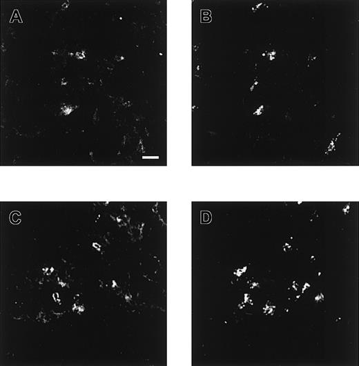 Fig. 6. Confocal microscopical analysis of lung stained with antiheparin antibodies. / Cryosections of human lung were incubated with periplasmic fractions of antiheparin antibodies EW4E1 (A) and EW4G1 (C). Bound antibodies were visualized by incubation with rabbit polyclonal anti–c-Myc IgG followed by Alexa 488–conjugated goat antirabbit IgG. Tryptase, present in mast cells, was visualized using mouse antihuman mast cell tryptase followed by Alexa 594–conjugated goat antimouse IgG (B, D). Both antiheparin antibodies react strongly with mast cells. Scale bar, 100 μm.