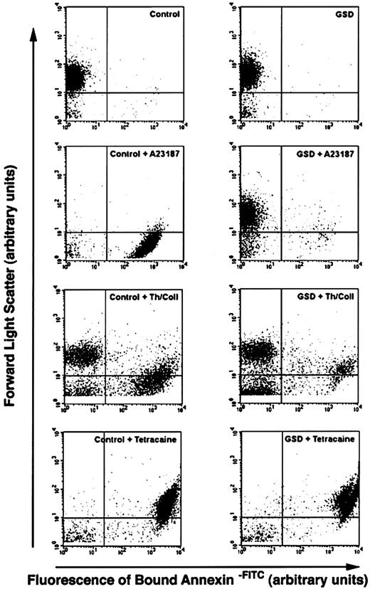 Fig. 5. Flow cytometry analyses of unstimulated and agonist-treated platelets from control and affected dogs labeled to detect surface exposure of PS. / Dot plots depict platelet suspensions from a healthy dog (control) and an affected GSD labeled with annexin V-FITC, a fluorescein-conjugated protein with high affinity for membrane surface aminophospholipid. The platelet suspensions were stirred in a buffer containing 2 mM CaCl2, in the absence of agonist compounds (A,B) or in the presence of one of the following treatments: A23187 (3 μM A23187, 25 minutes at room temperature); Th/Coll (0.5 U/mL thrombin plus 24 μg/mL collagen, 25 minutes at room temperature); tetracaine (2 mM tetracaine, 60 minutes at 37°C). Unstimulated control and GSD platelets are not labeled, indicating a lack of surface PS. All 3 treatments induced surface PS exposure in control dogs, denoted by the appearance of high-intensity fluorescence. The ionophore A23187 and thrombin plus collagen also induced a marked decrease in forward scatter for all or a portion of the labeled control platelets. The GSD platelets demonstrated virtually no increase in surface PS in response to A23187 and a relatively minor increase in PS exposure in response to thrombin plus collagen. Exposure of PS in response to tetracaine was equivalent to that of control dogs. Arrows indicate increasing forward light scatter intensity and increasing green fluourescence intensity. Data were collected without gating. The horizontal quadrant marker is at the lower boundary of forward scatter for unstimulated platelets, and the vertical marker is set at the upper boundary of fluorescence for more than 95% of the unstimulated platelets (indicating nonspecific fluorescence). Particles in the lower left quadrant of each plot represent debris and machine noise. These plots correspond to a single analysis, representative of results obtained from agonist treatment of all 5 affected GSDs.
