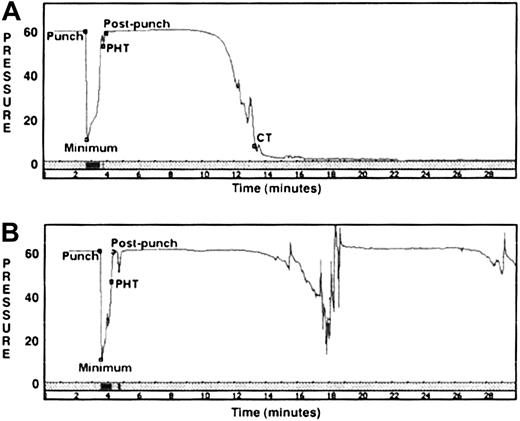 Fig. 6. CSAs. / Pressure time tracings are depicted for a healthy control dog (A) and an affected GSD (B). The CSA measures pressure (mm Hg) in a cassette chamber containing nonanticoagulated blood flowing in plastic tubing. The labeled events include the following: punch = lumen pierced by fine needle; minimum = low pressure caused by blood exiting punch hole; PHT (pressure is restored by thrombi sealing punch hole); postpunch = return to baseline blood flow; CT (luminal flow is occluded by clot). Control dog: PHT = 1.1 minutes, CT = 13.4 minutes; GSD: PHT = 0.7 minutes; CT = more than 30 minutes. The 5 affected GSDs demonstrated a variable number of transient pressure drops in the postpunch period; however, all consistently failed to form an occlusive clot.