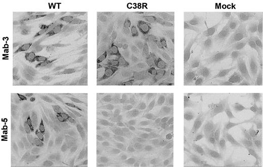Fig. 2. Immunostaining of BHK cells transfected with WT or Cys38Arg factor XI. / Cells grown on glass slides were reacted with 2 different anti–factor XI monoclonal antibodies, and immune complexes were detected by antimouse IgG coupled to alkaline phosphatase. The mAb-3 directed against an epitope on apple 2 detected Cys38Arg factor XI in the cells, whereas the mAb-5 directed against an epitope on apple 1 (the site of the mutation) failed to detect Cys38Arg factor XI. Original magnification × 200.