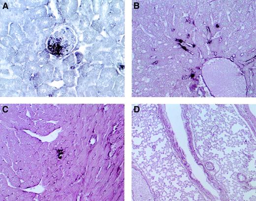 Fig. 2. Microscopic findings in AT+/− mice after LPS challenge. / Immunohistochemical staining with anti-fibrin–fibrinogen antibody of the kidney (A), liver (B), heart (C), and lung (D) of AT+/−mice. Fibrin deposition was detected in the kidney glomeruli (A), liver sinusoids (B), and small vessels of the myocardium (C). Almost no deposition was observed in the lung (D). Magnifications, ×400 (A-C), ×100 (D).
