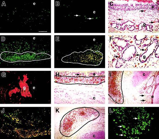 Fig. 1. Human leukocyte populations in simple bronchial grafts and bronchus–PLN cografts. / Mature simple bronchial grafts (A-C) show dispersed CD45+ mucosal leukocytes (A), including tryptase+ mast cells (B, arrows) and CD68+macrophages (C, arrows). Bronchus–PLN cografts (D-L) show CD45+ leukocytes (D) dispersed in the mesenchyme and clustered in BALT (D, circled area). BALT cells (E, circled area) include mature CD20+ B cells (green fluorescence) and CD20+CD38+ (orange fluorescence) plasma cells. Some CD38+ plasma cells are found at the basal aspect of submucosal glands (F, arrows), allowing for transcytosis-mediated IgA secretion (G) into the gland lumen. CD3+ T lymphocytes are found within the epithelium (H, arrow) of bronchus–PLN cografts, among BALT cells (H, circled area) and are dispersed in the mesenchyme (I, arrows). Co-implanted PLNs stay well delimited (I-K, circled area) externally to the cartilage and show numerous CD3+ T lymphocytes (I), mature CD20+ B cells (green fluorescence), and CD20+CD38+ (orange fluorescence) plasma cells (J) and CD68+ macrophages (K). Human PLNs maintained long term in the SCID host also show evidence of proliferating Ki67+ leukocytes (L). Bar represents 100 μm in A, B, D, E, J; 250 μm in I, K; 50 μm in C, H; 25 μm in F, G, L. e indicates epithelium; g, gland; and c, cartilage. Original magnification ×50 (A, B, D, E, J); ×20 (I, K); ×100 (C, H); ×200 (F, G, L).