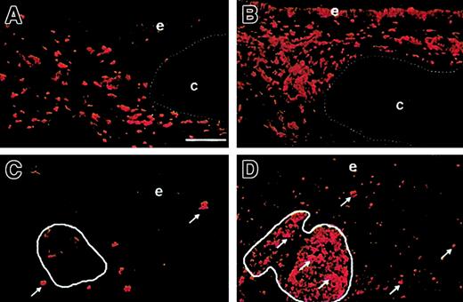 Fig. 2. Markers of αβ T-cell–mediated immunity in simple bronchial grafts and bronchus–PLN cografts before and after infection with P aeruginosa. / Before P aeruginosa infection, the up-regulation of HLA-DR is visible in the bronchus–PLN cograft (B) compared with the simple bronchial graft (A), with strong staining of the epithelium and the mesenchymal macrophages. Before infection, few mesenchymal macrophages express CD25 (C, arrows) in the bronchus–PLN cograft, whereas BALT cells (C, circled area) are mostly CD25−. After in vivo infection with P aeruginosa, CD25 expression is markedly up-regulated (D, arrows) in the mesenchyme of the bronchus–PLN cograft, notably among BALT cells (D, circled area), with CD25+ cells spreading in the whole mucosa and the epithelium. Bar, 100 μm. e indicates epithelium; and c, cartilage. Original magnification ×100 for all panels.