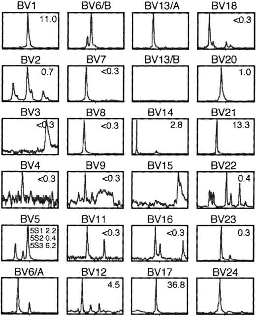 Fig. 4. Analysis of length distribution of TCRβ junctional sequences in cells from the mucosa of a bronchus–PLN–thymus cograft. / Shown are the profiles of cDNA amplified with pairs of Vβ–Cβ primers plus run-off with internal fluorescence Cβ primer. The percentage of cells expressing corresponding TCR Vβ, as estimated by flow cytometry, is indicated in the upper right corner of each histogram. Staining was considered significant when it was greater than 0.3%. According to this criterion, at least 12 of 24 distinct Vβ subsets were detected by flow cytometry. Immunoscope analysis suggested that the culture contained at least 40 distinct clonotypes.