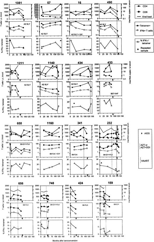 Fig. 2. Longitudinal data of HIV-infected individuals during the course of infection. / Months are given from time of seroconversion, AIDS diagnosis is indicated with arrows on the x-axes, and HAART, dual therapy, or monotherapy is indicated with dotted lines and defined in Table 1. Upper panels show CD4+ (▪) and CD8+ (♦) T-cell numbers and viral RNA copies per milliliter serum (thick lines). Middle panels indicate absolute numbers of tetramer+ T cells (●) and IFN-γ–producing T cells (○). HLA restrictions and dominant peptide responses are indicated by the first 3 amino acids of the peptides described in “Patients, materials, and methods.” The IFN-γ+ fraction of tetramer+ T cells is plotted in the lower panels (▵). Results of replicate measurements are indicated in the lower panels (▴).