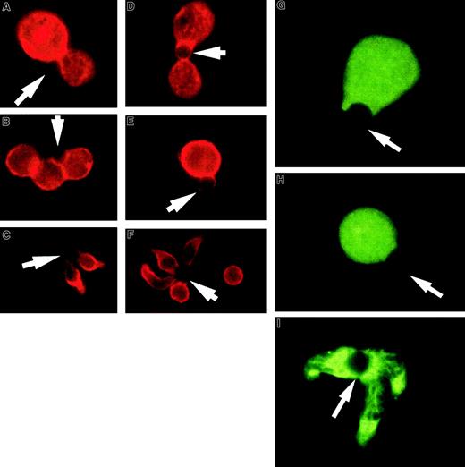 Fig. 2. T-cell hybridoma activation does not lead to significant cell shape and CD43 polarization or lipid raft coalescence. / Hybridoma- or column-purified splenic T cells were conjugated with beads coated with anti-CD3 and anti-CD28, fixed, and stained for CD43. (A,D) Examples of 3D9 hybridoma-bead conjugation where CD43 does not modulate away from the interaction site. (B,E) Examples of D0.11.10 hybridoma-bead complexes. The red CD43 staining is clearly visible at the cell-bead contact area. (C,F) Unprimed T cells activated with the same beads. During the activation, the cells change shape and CD43 accumulates away from the bead contact site, toward the uropodlike structure. At the right image the cell not conjugated with the bead demonstrates the typical CD43 distribution on unstimulated cells. The arrows denote location of the beads. (G-I) T-cell hybridomas or column-purified spleen T cells were conjugated with beads coated with anti-CD3 and anti-CD28, fixed, and permeabilized as described in “Materials and methods.” Rafts were visualized with FITC-labeled cholera toxin B subunit. (G) An example of 3D9 hybridoma cell-bead conjugate. (H) An example of a D0.11.10 hybridoma cell-bead complex. Both photographs show dispersed noncoalescent lipid rafts after activation of the T-cell hybridomas. (I) Unprimed T cells activated at the same time show redistribution of lipid rafts and their coalescence at the cell-bead interface. The results are representative of at least 3 experiments. The arrows indicate location of the beads. Magnification × 1000.