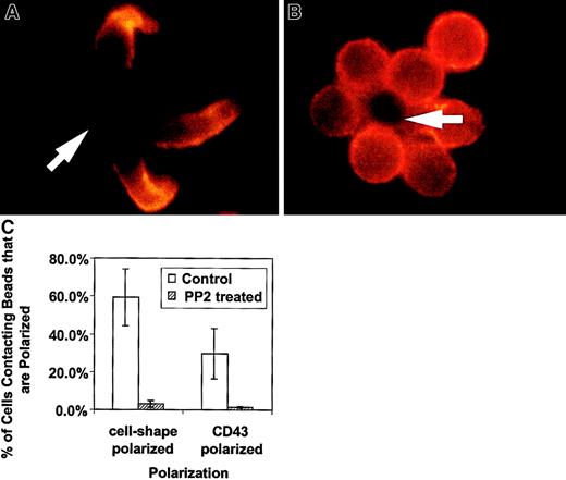 Fig. 3. The Src kinase inhibitor, PP2, blocks the cell shape and CD43 polarization of activated primary T lymphocytes. / Purified CD4+ splenic T cells were preincubated with 20 μM PP2 in complete medium, then activated with beads coated with anti-CD3 and anti-CD28, fixed, and stained for CD43 as described in “Materials and methods.” (A) Control T cells untreated with PP2 inhibitor and activated at the same time as treated cells. The cells are clearly polarized and CD43 is redistributed away from the cell-bead contact site. (B) Cells treated with the inhibitor and activated. They are characterized by a round shape and lack CD43 redistribution. The results are representative of 2 experiments. The arrows indicate location of the beads. (C) Quantitation of cell shape and CD43 polarization of primary T lymphocytes treated with PP2. The bars represent the cells polarized as a percentage of bead-conjugated cells from 2 experiments. The results for PP2 treated (striped bar) and for control (white bar) T cells are shown. Two slides with 50 to 110 bead-conjugated cells counted on each were evaluated in an experiment. The error bars represent 1 SD. The difference for cell shape polarization was significant at P < .005 and the difference for CD43 polarization was significant atP < .05. Magnification × 1000.