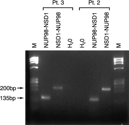 Fig. 2. Detection of NUP98-NSD1 andNSD1-NUP98 fusion transcripts in 2 t(5;11)(q35;p15.5) patients by RT-PCR. / RT-PCR products from bone marrow mononuclear cells of patient 3 (in first remission) and patient 2 (at diagnosis). A 135-bp product of theNUP98-NSD1 fusion transcript and a 200-bp product of theNSD1-NUP98 fusion transcript were detected in both patient samples. H2O denotes negative controls without DNA. M denotes the PhiX174HaeIII molecular weight marker (Roche Diagnostics).