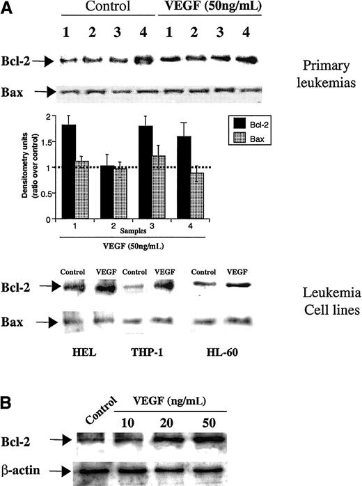 Fig. 1. Bcl-2 expression on primary leukemias, leukemic cell lines, and HL-60 cells. / (A) VEGF induces Bcl-2 expression on primary leukemias and leukemic cell lines. Cells were left untreated or stimulated with VEGF (50 ng/mL) for 24 hours. Total protein extracts were obtained and Bcl-2/Bax was detected by Western blotting (see “Materials and methods” for details). Western blotting results were quantified by densitometry and are shown as the ratio between densitometry values in treated versus untreated (control) cells. Each experiment was repeated 3 times, and the SD between the different ratios was calculated and is shown. (B) VEGF induces, in a dose-dependent manner, Bcl-2 expression on HL-60 cells. As a control for protein loading, β-actin levels are also shown.