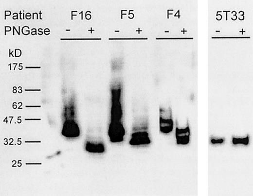 Fig. 1. Glycosylation of scFv proteins expressed in. / P pastoris. Culture supernatants containing scFv proteins derived from patients (F4, F5, and F16) and from the 5T33 mouse myeloma were separated by SDS-PAGE and visualized by Western blotting using 9E10 monoclonal antibody. The scFv proteins were either untreated (−) or treated (+) with PNGase.