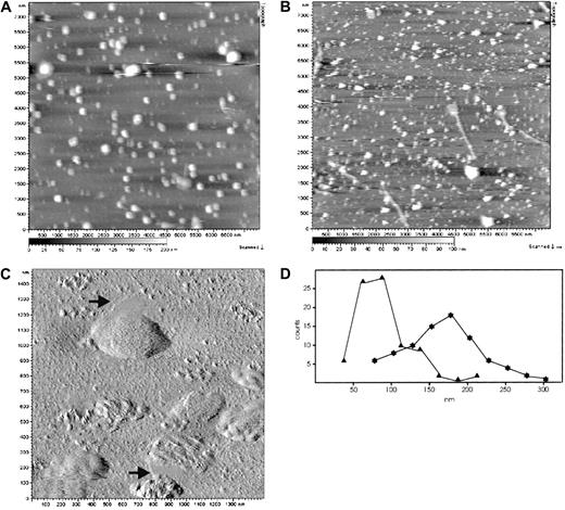 Fig. 1. AFM images of erythrocyte microvesicles and nanovesicles. / Microvesicles (panels A, C) and nanovesicles (panel B) were adsorbed to WGA-coated mica surfaces. (A) (B) Topography images were obtained with the use of the Mac mode in buffered saline. Singly distributed vesicular structures are clearly resolved. Heights are indicated by a gray scale bar, ranging from 0 nm (black) to 200 nm (white) (panel A) and from 0 nm (black) to 100 nm (white) (panel B). Image size was 7.5 μm. (C) The high-resolution AFM amplitude image reveals distinct, texturelike structures on the microvesicular membranes and flat membrane patches that are occasionally associated with the microvesicles (arrows). Image size was 1.5 μm. (D) Size distribution of microvesicles (n = 82, asterisks) and nanovesicles (n = 85, triangles). Maxima are found at 179 nm and 81 nm, respectively.