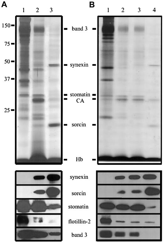 Fig. 2. Identification of proteins in erythrocyte microvesicles and nanovesicles. / (A) Erythrocytes were treated with Ca++/A23187, and microvesicles and nanovesicles were prepared according to method A. Aliquots of the erythrocyte membranes (lane 1), microvesicles (lane 3), and nanovesicles (lane 3), normalized to AChE activity, were analyzed by 12% polyacrylamide gel electrophoresis/silver staining (upper panel) and immunoblotting (lower panel) as indicated. (B) Vesicles were prepared according to method B. Aliquots, normalized to AChE activity, of the erythrocyte membranes (lane 1) and vesicles obtained after low-speed centrifugation for 10 minutes (lane 2) and 20 minutes (lane 3) and ultracentrifugation (lane 4) were analyzed as in panel A. CA indicates carbonic anhydrase; Hb, hemoglobin.