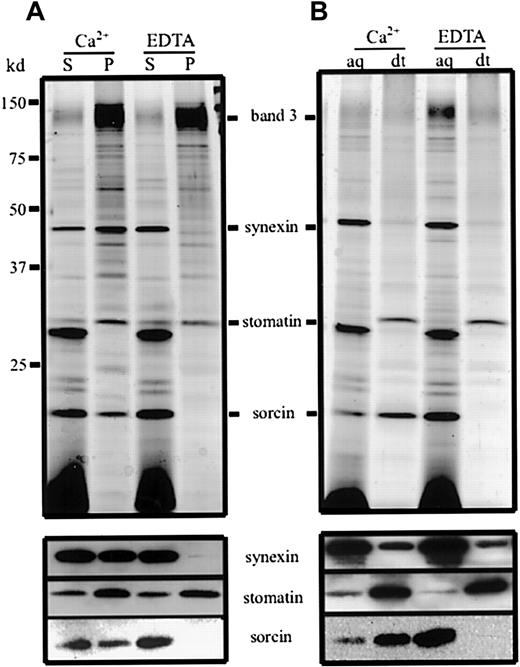 Fig. 3. Ca++ dependence of the synexin and sorcin membrane association and change in sorcin hydrophobicity. / (A) Mixtures of microvesicles and nanovesicles were lysed by 0.5% saponin in the presence of Ca++ or EDTA. The vesicle membranes were pelleted, and aliquots of the supernatants (S) and pellets (P) were analyzed by 12% polyacrylamide gel electrophoresis/silver staining (upper panel) and immunoblotting (lower panel). (B) Mixtures of microvesicles and nanovesicles were dissolved in Triton X-114 in the presence of Ca++ or EDTA, and phase separation was performed. Aliquots of the aqueous (aq) and detergent (dt) phases were analyzed by 12% polyacrylamide gel electrophoresis/silver staining (upper panel) and immunoblotting (lower panel).