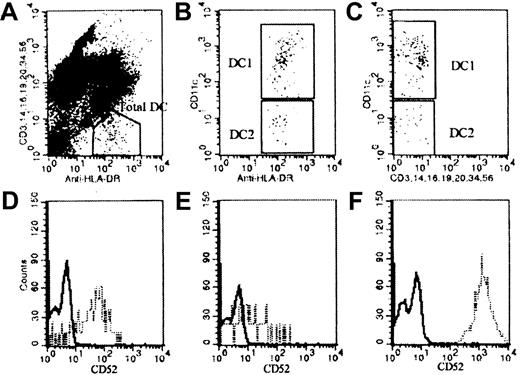 Fig. 1. DC enumeration and CD52 staining on DCs and T cells. / Peripheral blood sample from a healthy donor was stained with anti–HLA-DR and the mixture of antibodies specific for lineage markers CD3, CD14, CD16, CD19, CD20, CD34, and CD56. Anti-CD11c was also used to separate DCs into 2 subsets. (A) Total DC enumeration. (B,C) DC1 (CD11c+) and DC2 (CD11c−) staining. Peripheral blood DCs were also stained for the expression of CD52. (D) D52 expression on DC1. (E) CD52 expression on DC2. (F) CD52 expression on T cells where the closed line represents isotype control staining and broken line represents CD52 staining.