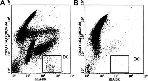 Fig. 3. Depletion of DCs by in vivo Campath. / Circulating host DCs were depleted 24 hours after the first dose of Campath antibody. In this case the number of DCs fell from 19.19 × 106/L (A) to 0.80 × 106/mL (B).