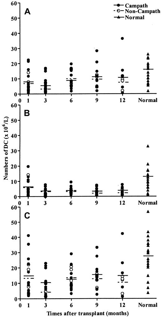 Fig. 4. DC reconstitution after allogeneic transplantation. / Regeneration of peripheral blood DCs after transplantation was not affected by pretransplant Campath. (A) DC1 regeneration. (B) C2 regeneration. (C) Total DC regeneration.