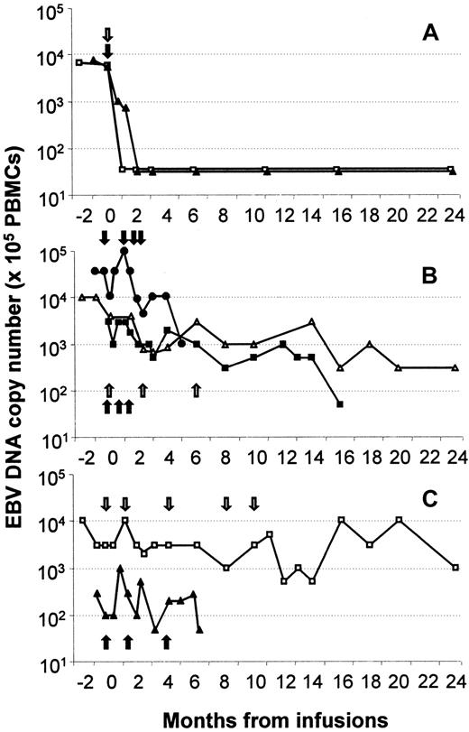 Fig. 1. Sequential analysis of EBV DNA levels in the peripheral blood of the 7 patients treated with EBV-CTL lines. / (A) This panel shows EVB DNA dynamics in patients 1 (□) and 2 (▴), (B) refers to patients 3 (●), 5 (▵), and 7 (■); and (C) refers to patients 4 (□) and 6 (▴). Arrows indicate CTL infusions.