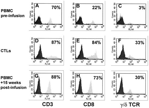 Fig. 2. T-cell phenotype analysis in patient 2. / Results obtained from PBMCs collected at +15 weeks from infusion are compared with phenotype analysis performed on the transferred CTL line and on the patient's preinfusion PBMCs. (A,D,G) These panels refer to CD3+ cells, (B,E,H) to CD8+ subset, and (C,F,I) to T-cell receptor γδ+ population. An impressive peripheral expansion of CD8+ and T-cell receptor γδ+ T cells is observed in the patient after CTL infusion. Data are expressed as the percentage of positive cells.