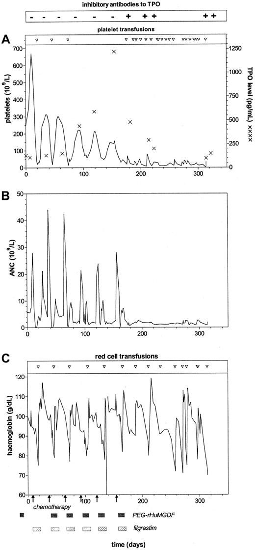 Fig. 1. Development of anti-TPO antibodies and association with thrombocytopenia, neutropenia, and anemia. / Shown is the development of anti-TPO antibodies in the patient in relation to administration of PEG-rHuMGDF (shaded boxes) with chemotherapy (arrows) and G-CSF. Inhibitory antibody to TPO was not detected by RIA or bioassay on 6 occasions (minus signs). Inhibitory antibody to TPO was detected by RIA on 5 occasions (plus signs) and also by bioassay on 4 of these. The first sample positive on RIA was negative on bioassay. In the 4 samples positive on bioassay, inhibitory antibody to TPO was detected at serum dilutions of 1:200, 1:100, 1:100, and 1:100. (A) Platelet count, platelet transfusion requirements, and serum TPO levels (asterisks). (B) ANC. (C) Hemoglobin levels and red blood cell transfusion requirements.
