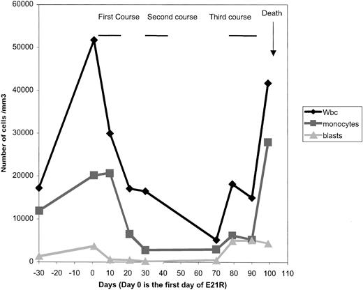 Fig. 1. CBC evolution and outcome. / A dramatic response was observed after the end of the first course. During and after the third course, WBC, monocytosis, and blast cell counts increased.