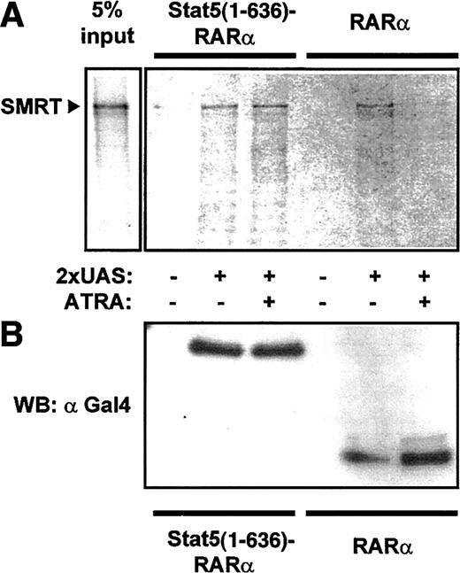 Fig. 4. Stat5-RARα fusion proteins induce ATRA-insensitive interaction with SMRT. / (A) Cellular extracts from 293T cells expressing Gal4 fusions of Stat5(1-636)–RARα and RARα were incubated with radiolabeled SMRT and precipitated with a 2 × UAS oligo. SMRT could be detected in precipitates with Stat5(1-636)–RARα in the absence or presence of ATRA (10−5 M). In contrast, no SMRT binding was seen in the presence of ATRA with extracts containing RARα. (B) Western blot performed with 30% of precipitated proteins using an anti-Gal4 antibody showed equal binding of both Gal4-fusion proteins to the oligo.
