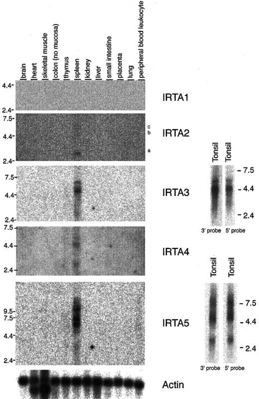 Fig. 5. IRTA family mRNA expression is limited to lymphoid tissues in analysis of normal organs. / Northern blot analysis of IRTA1, IRTA2, IRTA3, IRTA4, andIRTA5 using 2 μg polyA-selected RNA. For IRTA3and IRTA5, both 5′ and 3′ end probes were used. The positions of the probes within the mRNAs are shown in Figure 1. IRTA2 isoforms a, b, and c are indicated.