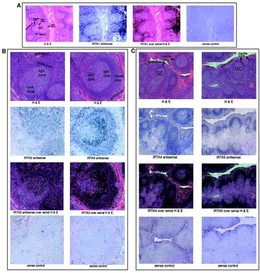 Fig. 7. IRTA family mRNAs have gene-specific localization patterns within normal tonsil tissue. / In situ hybridization of hyperplastic human tonsil to IRTA antisense RNA probes, as indicated. For each panel 3 serial sections are shown; the third frame represents an overlay of the antisense RNA signal (with blue changed to black) and the serial section stained with hematoxylin and eosin (H&E). For each set a section was processed in parallel with a sense RNA probe to control for background signal. GC indicates germinal center; MargZ, marginal zone. Original magnification A, × 20; B, × 50; C, × 15.