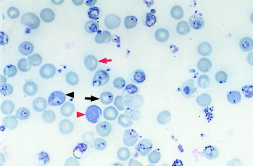 Fig. 1. Measuring infection of reticulocytes and normocytes. / Differential counts of erythrocyte types were performed by counting the number of infected normocytes (black arrow), uninfected normocytes (red arrow), infected reticulocytes (black arrowhead), and uninfected reticulocytes (red arrowhead). Original magnification, × 1000; stain, Wright-Giemsa.