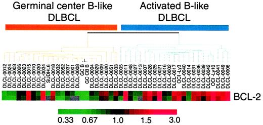 Fig. 5. Gene-expression patterns of bcl-2 on complementary DNA analysis in germinal center B-like and activated B-like large B-cell lymphomas. / Maximum red and green results indicate expression levels 3 fold above and below baseline values, respectively. This array shows a significant (P2 = .003) association between increased bcl-2 expression and the activated B-like genotype, and these results suggest that bcl-2 protein expression may identify tumors with the activated B-cell genotype.