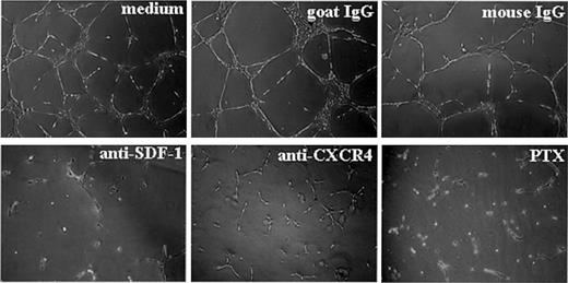 Fig. 4. SDF-1/CXCR-4 regulation of ECM-dependent tube formation by endothelial cells. / HUVECs (30 × 104) were plated on Matrigel-coated, 48-well plates and were incubated for 16 hours in medium alone, with PTX, or with antibodies (neutralizing goat IgG antihuman SDF-1; control goat IgG; neutralizing murine monoclonal antihuman CXCR4 IgG2A, clone12G5; or control murine IgG2A, hybridoma 20102.1; all at 10 μg/mL). Images reflect tube formation after 16-hour incubation detected by phase-contrast microscopy (original magnification, ×5). Representative results from 4 experiments.