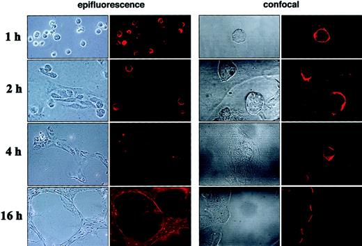 Fig. 5. Time-dependent changes of CXCR-4 expression and localization during ECM-dependent endothelial cell tube formation. / HUVECs (10 × 103) were plated on Matrigel-coated, glass chamber slides (2-well) and were incubated at 37°C for 1, 2, 4, and 16 hours. After incubation, cells were fixed with 1% formaldehyde and examined unstained with a phase-contrast microscope or stained for CXCR-4 with a murine monoclonal antihuman CXCR4 antibody (IgG2B, clone 44716.111) followed by Alexa 568–conjugated goat antimouse IgG, and they were examined with an epifluorescence microscope with or without a confocal system. Representative images from phase-contrast microscopy showed different stages of HUVEC migration and assembly into tubular structures at 1, 2, 4, and 16 hours. Parallel changes in levels and distribution of CXCR-4 surface expression on HUVEC detected by epifluorescence (original magnification, ×20 all time points except ×10 at 16-hour time point) and confocal microscopy (original magnification, ×60).