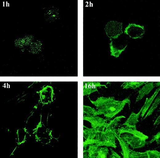 Fig. 6. F-acting expression and distribution in HUVECs undergoing tube formation on Matrigel. / HUVECs (10 × 103) incubated on Matrigel-coated glass chamber slides at 37°C for 1, 2, 4, and 16 hours were stained with phalloidin–FITC and were photographed under confocal microscopy (original magnification, ×60 at all time points except ×20 at 16-hour time point).