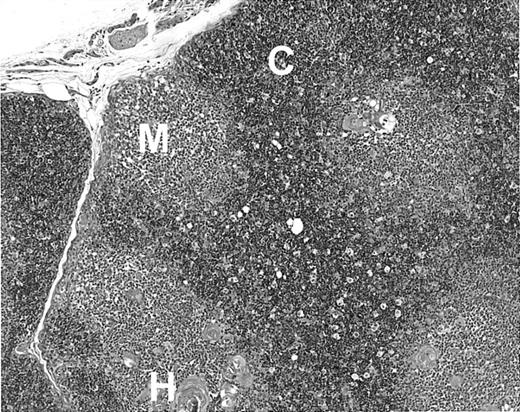 Fig. 1. Histology of thymus–liver transplant in Rag2−/−/γc−/− mice. / Fetal thymus and liver fragments were grafted subcutaneously. The thymus graft was removed 9 months after transplantation. Magnification, × 250. M indicates medulla; C, cortex; H, Hassal corpuscles.