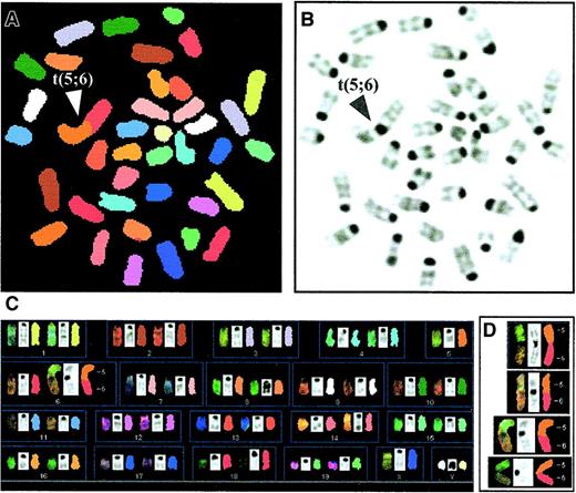 Fig. 6. Increase in cytogenetic aberrations in Y+ primary transplanted G3 mTerc−/− BM cells. / Spectral karyotyping was performed on metaphases of transplanted wildtype and G3 mTerc−/− B6 BM male cells after 5 months of transplantation into female myeloablated hosts. (A) Image of a typical mTerc−/− metaphase after SKY analysis showing a robertsonian translocation between chromosomes 5 and 6 (classified colors). (B) Corresponding reverse 4′6-diamidino-2-phenylindole·2HCl (DAPI) image of the same metaphase. (C) Complete karyotype of the same metaphase showing the chromosomes by spectral, DAPI, and classified images, respectively. (D) Examples of the clonal t(5;6) translocation in G3 mTerc−/− B6 BM cells.