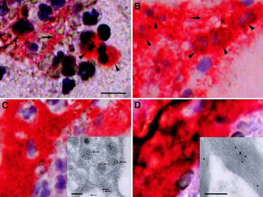 Fig. 2. Immunohistochemical and immunoelectron microscopical analyses of particulate material trapped in the PercuSurge filter. / Red immunoreactivity indicates positive staining in parallel sections. (A) TF in association with distinct cells (arrowheads) and the extracellular compartment (horizontal arrow). The scale bar represents 10 μm. (B) The majority of cells (arrowheads) and extracellular areas (horizontal arrow) stain with anti-CD15 antibody, a marker for mature granulocytes, and monocytes. (C) (D) Documentation of positive staining with anti-CD61 and antifibrin antibodies, which suggests that platelets and fibrin colocalize with TF immunoreactivity. Ultrastructural micrographs of a platelet (insert) and fibrin (insert) obtained from a PercuSurge filter, immunostained with monoclonal anti-TF antibody. The scale bars represent 250 nm. Positive immunoreactivity is visualized with immunogold. Panel C demonstrates the accumulation of TF within platelet granular structures and on the outer membrane (fine arrows). All immunohistochemistry panels were photographed at the original magnification × 400. All immunogold stains were photographed at the original magnification × 28 800.