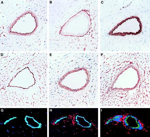 Fig. 4. Immunohistologic localization of NTPDases in cardiac vasculature. / Serial sections of a mouse heart were stained by immunohistochemistry with various antibodies detecting (A) NTPDase1, (B) NTPDase2, (C) α-actin (a marker of smooth muscle), (D) CD31 (a marker of endothelium), (E) NG2 (a marker of pericytes and smooth muscle cells), and (F) laminin (a marker of basement membranes). Positive reactions were seen as rust color (A-F), and sections were counterstained with hematoxylin (blue). In panels G-I, immunofluorescence and confocal analysis were performed: (G) CD31 in blue and NTPDase1 in green (colocalization as aquamarine); (H) as for panel G with addition of NTPDase2 in red; (I) NTPDase1 in green, smooth muscle α-actin in blue, and NTPDase2 in red (no colocalization). In medium-sized vessels, CD31 and NTPDase1 were found to colocalize while NTPDase2 did not colocalize with these 2 markers or the smooth muscle α-actin–expressing cells. Original magnifications, ×200.
