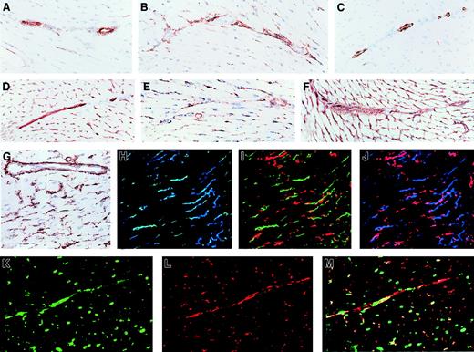 Fig. 5. Immunohistologic localization of NTPDases in the cardiac microvasculature. / Immunohistochemistry of mouse heart sections (A-G) are shown in the same order as in Figure 4. Antibody specificity: (A) NTPDase1, (B) NTPDase2, (C) α-actin (a marker of smooth muscle), (D) CD31 (a marker of endothelium), (E) NG2 (a marker of pericytes and smooth muscle cells), (F) laminin (a marker of basement membranes), and (G) a higher magnification of NTPDase2. Sections were counterstained with hematoxylin. In panels H-M, immunofluorescence and confocal analysis were performed: (H) NTPDase1 in green and CD31 in blue (colocalization is aquamarine); (I) NTPDase1 in green and NTPDase2 in red; (J) CD31 in blue and NTPDase2 in red (no colocalization); (K) pericyte marker NG2 in green; (L) NTPDase2 in red; (M) panels K and L combined (colocalization is yellow). In the microvasculature, NTPDase1 colocalized with an endothelial cell marker (CD31) while NTPDase2 colocalized with a pericyte marker (NG2). Original magnifications A-F and H-M, ×200; G, ×400.