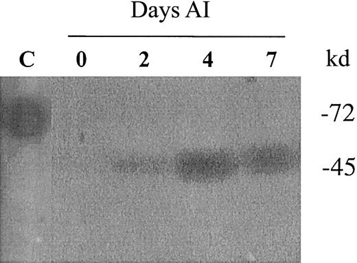 Fig. 3. The proteolytic activity of uPA is increased in regenerating muscle after injury. / Forty micrograms of proteins from muscle extracts of noninjured (0 days AI) and injured skeletal muscle (2, 4, and 7 days AI). were analyzed after SDS-PAGE by PA zymography. Two nanograms of purified human uPA (55 kd) were utilized as a control for activity (C). The 45-kd approximate molecular mass species corresponds to murine uPA and was calculated according to standard molecular mass markers electrophoresed in an adjacent lane and stained with Coomassie blue. The photographs were taken after overnight incubation at 4°C and 4 hours at 37°C.