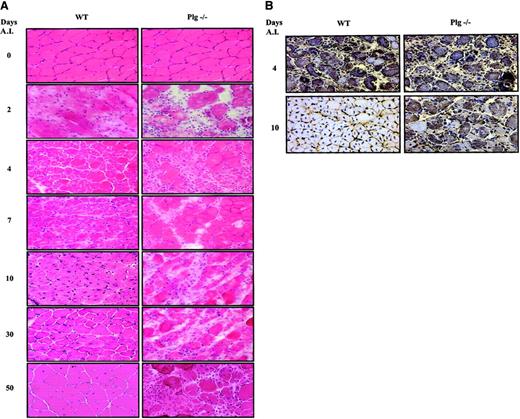 Fig. 5. Skeletal muscle regeneration is defective in Plg-deficient mice. / (A) Glycerol-induced injuries result in impaired skeletal muscle regeneration of Plg-deficient mice. Frozen sections of muscles from WT and Plg-deficient mice were stained with H/E after 2, 4, 7, 10, 30, and 50 days AI, as indicated. Contralateral control muscles were also stained with H/E (0 days AI). In WT mice, advanced regeneration is visible after 4 days, and regeneration is complete after 10 days. In Plg-deficient mice, a regeneration defect is already visible after 4 days AI but is most striking after 10 days. In WT mice, virtually no sign of the previous injury was detectable after 30 and 50 days, except for the centrally located myonuclei. Original magnifications × 400. (B) Persistence of MHCd-positive myofibers 10 days after glycerol injury in Plg-deficient mice. Cryostat frozen sections from WT and Plg-deficient mice were reacted with a monoclonal antibody against MHCd at 4 and 10 days AI, as indicated. Large numbers of MHCd-expressing myofibers are visible in regenerating muscle of Plg-deficient mice 4 and 10 days after intramuscular glycerol injection. In WT mice, MHCd-positive fibers are observed 4 days AI, whereas no MHCd-expression is detected 10 days AI. Original magnification × 400.