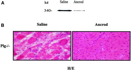 Fig. 7. Effect of systemic fibrinogen depletion on muscle regeneration of Plg-deficient mice. / Plg-deficient mice were implanted 3 days before glycerol-induced muscle degeneration with ancrod-filled mini-osmotic pumps (3U/d over 13 days) (ancrod) or with buffered-filled pumps (saline). (A) Ancrod treatment reduces fibrinogen in blood of Plg-deficient mice. Forty micrograms of sodium citrate–treated blood obtained from saline- or ancrod-infused mice was analyzed in a 6% polyacrylamide gel by Western blotting using a polyclonal antimouse fibrinogen antibody (1:1000). The 340-kd approximate molecular mass species indicated by an arrow corresponds to murine fibrinogen and was calculated according to standard molecular mass markers electrophoresed in an adjacent lane. (B) Fibrinogen depletion restores muscle regeneration in Plg-deficient mice. Cryosections from saline- and ancrod-treated Plg-deficient mice were stained with H/E 10 days AI. While well-advanced regeneration is visible in ancrod-treated Plg−/− mice, a regeneration defect is still observed in saline-treated mice 10 days after injury. Original magnification × 400.