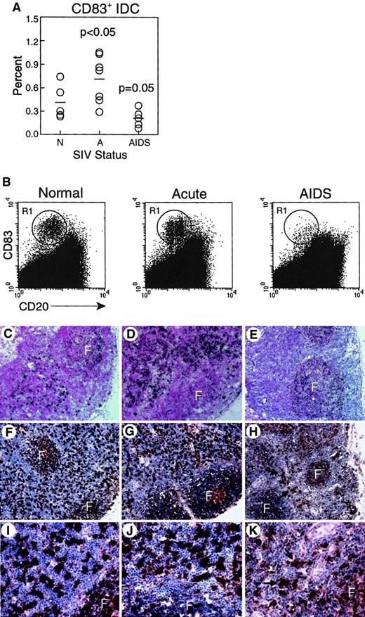 Fig. 4. CD83+ IDC in lymph nodes are increased during acute SIV infection but decreased during AIDS. / (A-B) Lymph node cell suspensions were labeled and gated for expression of CD83 and lack of CD20 to identify IDCs. (A) Proportion of CD83+ IDCs in unseparated lymph nodes from normal, healthy monkeys (N, n = 5), and monkeys with acute SIV infection (A, n = 7), or AIDS (n = 5). IDCs are increased in acute SIV infection (P < .05) and decreased during AIDS (P = .05) as compared to normal, healthy animals. Each circle represents a different animal, and horizontal bars represent the mean. (B) Representative dot plots of lymph node cells from healthy monkeys and monkeys with acute SIV infection or AIDS; 400 000 events are shown to highlight IDCs (R1). (C-K) CD83 expression in lymph nodes was analyzed using in situ hybridization for CD83 RNA (C-E) and immunohistochemistry for CD83 protein (F-K) in healthy monkeys (C,F,I), and monkeys with acute SIV infection (D,G,J), or AIDS (E,H,K). Infrequent CD83+ IDCs in monkeys with AIDS are highlighted by arrows. F indicates follicle. Ab staining was detected using streptavidin-peroxidase with diaminobenzidine substrate. Tissues were counterstained with eosin (C-E) or hematoxylin (F-K). Original magnification × 100 (C-E), × 200 (F-H), × 600 (I-K).