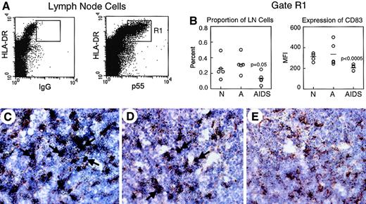 Fig. 7. IDCs from lymph nodes of monkeys with AIDS have markedly reduced expression of CD83. / (A-B) Lymph node cells were stained with mAb to HLA-DR and p55 to identify IDCs. (A) Representative dot plots of cells from a healthy monkey stained with mAb to HLA-DR and either control IgG (left) or p55 (right), showing the HLA-DRhi p55+ IDC (R1). (B) On the left the proportion of HLA-DRhi p55+IDCs in unseparated lymph node cells from normal, healthy monkeys (N, n = 5) and monkeys with acute SIV infection (A, n = 5) or AIDS (n = 5) is shown. IDCs are reduced in lymph nodes of monkeys with AIDS relative to normal animals (P = .05). On the right, the expression of CD83 on the HLA-DRhip55+ IDCs is shown. Expression of CD83 is reduced in monkeys with AIDS compared to normal animals (P < .0005). Each circle represents a different animal, and horizontal bars represent the mean. (C-E) Lymph node sections from a healthy monkey (C) and monkeys with acute SIV infection (D) or AIDS (E) were labeled by in situ hybridization for CD83 RNA (black) and immunohistochemistry for p55 protein (brown). Double-labeled IDCs in lymph nodes of the healthy monkey and monkey with acute SIV infection are highlighted by arrows. Ab staining was detected using streptavidin-peroxidase with diaminobenzidine substrate. Tissues were counterstained with hematoxylin. Original magnification × 600.