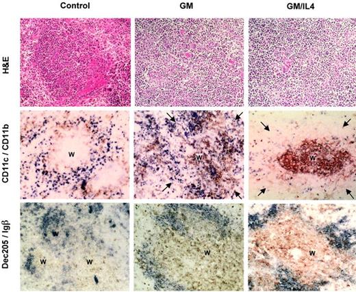 Fig. 4. Histology and immunohistology of DC subsets. / Magnification, × 20. (top panel) Hematoxylin and eosin. Cytokine therapy resulted in a mixed cellular infiltrate and distortion of normal follicle structure. (middle panel) CD11c (brown) and CD11b (blue) immunostain. Treatment with either GM alone or with GM/IL-4 resulted in enlarged and somewhat disorganized follicles (arrows). GM increased the number of CD11b+ and CD11c+ cells distributed throughout the white pulp (W) and marginal zones. GM/IL-4 preferentially increased the CD11c+ population with a marked localization to the white pulp. (bottom panel) DEC-205 (brown) and Igβ (blue) immunostain. Igβ identifies B cells and highlights the enlarged follicles in cytokine-treated mice. Control mice demonstrated light staining for DEC-205 within follicle centers. GM therapy was associated with an increase in DEC-205 staining, consistent with the increase in follicle size. In contrast, rGM/rIL-4 resulted in intense staining of tightly packed DEC-205+ cells within the centers of follicles.