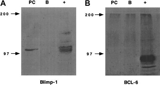 Fig. 3. Plasma cell expression of transcription factors. / The expression of Blimp-1 and BCL-6 by E/P−/− plasma cells or wild-type IgM+ B cells was determined by Western blot using rabbit polyclonal antiserums. The murine plasmacytoma cell line, J558, served as the positive control (+) for Blimp-1 expression and BJAB cells served as the positive control (+) for BCL-6 expression. A representative experiment of 2 independent plasma cell and IgM+ B cell isolations is shown.