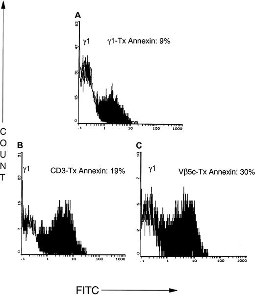 Fig. 7. Antibodies that bind to CD3 or the clonotypic TCR cause rapid apoptosis of CTCL cells. / CTCL cells were CD2–bead purified from 2-month cultures and incubated for 1 hour with an isotype control (A; IgG1), CD3 (B), or an antibody to the variable region of the β chain of the clonotypic TCR (C; Vβ5c). Apoptosis was assessed by the binding of annexin V–FITC, a marker of early apoptotic cells. Tx indicates treatment.