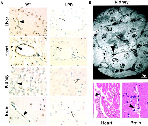 Fig. 1. Systemic CD95 engagement induces disseminated vascular endothelial cell death. / (A) The TUNEL assay shows apoptosis (brown staining) of vascular endothelial cells (filled arrowheads) and additional cell types in tissue sections from liver, heart, kidneys, and brain of wild-type (WT) mice killed 2 hours after injection of the JO2 CD95-specific antibody, whereas no apoptotic lesions were detected in CD95-defectivelpr (LPR) mice killed 6 hours after JO2 injection (the unstained endothelial cells are indicated by open arrowheads). (B) Endocardial lesions (heart) and subarachnoidal hemorrhage suffusions (brain), as well as typical electron microscopy features of endothelial cell apoptosis (kidney) were observed in wt mice killed 2 hours after JO2 injection (filled arrowheads).