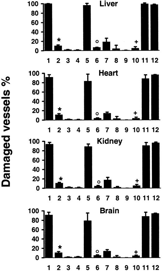 Fig. 2. Quantification of vascular lesions induced by systemic CD95 engagement. / Wt mice were injected with JO2 (1) (n = 9), JO2 plus caspase-8 inhibitor (2) (n = 4), control immunoglobulin (3) (n = 4), LPS (> 150-fold excess of LPS content in JO2) (4) (n = 4), smCD95L (5) (n = 4), smCD95L plus caspase-8 inhibitor (6) (n = 4), sCD95L (7) (n = 5), the anti-FLAG antibody used to multimerize the sCD95L (8) (n = 5), or remained untreated (9) (n = 5); JO2 was injected in lpr mice (10) (n = 7), in gld mice (11) (n = 7), or in TNF-α−/−–Ltα−/−mice (12) (n = 4). Percentages are mean ± SD of 2 independent counts on tissue sections from liver, heart, kidneys, and brain of(n) different mice, as described in “Materials and methods.” *P < .007 compared to 1; °P < .03 compared to 5;+P < .002 compared to 1, 11, and 12 (Wilcoxon test).